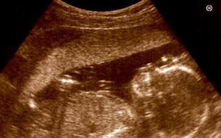 Внутриутробное развитие ребенка на шестнадцатой неделе беременности Что чувствует женщина на 16 неделе беременности