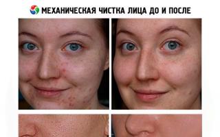 Механическая чистка для лица: подробная инструкция проведения процедуры Чистка лица у косметолога механическая